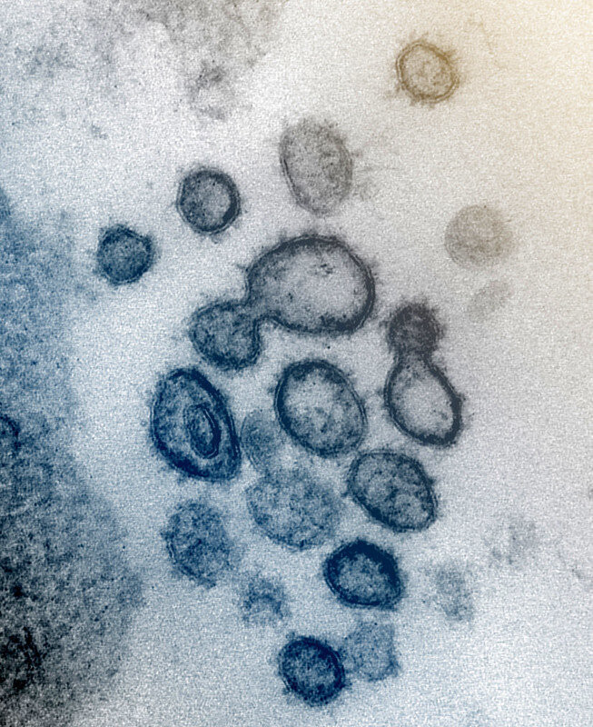 The coronavirus exiting a cell. (provided by NIAID)