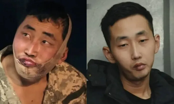 유용원 “북한군 포로 2명 한국 도착 확인”…젤렌스키도 유엔서 밝혀