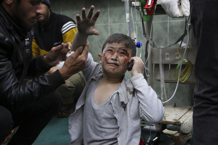 A Palestinian child injured in an attack by Israeli forces is treated at a hospital in Rafah, Gaza Strip, on March 24, 2024. (AP/Yonhap) 