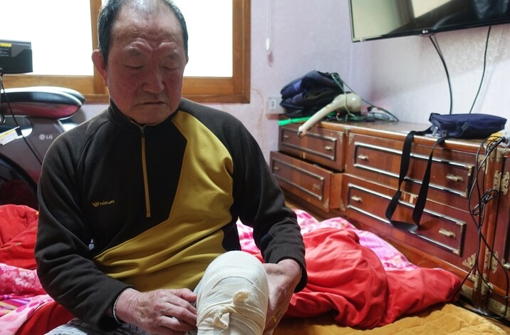 Yang Chang-ok ties a bandage around the leg that police yanked on when he was young.