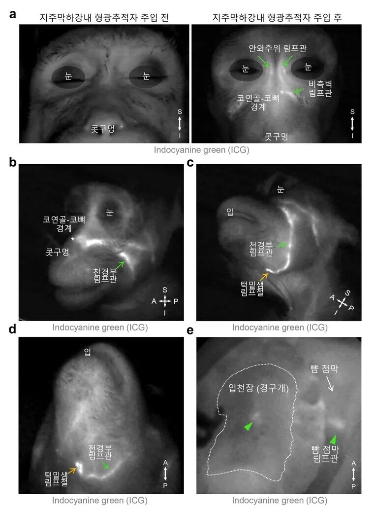 영장류에서 관찰된 뇌척수액 배출 림프관 분포. 뇌막에 주입된 뇌척수액 형광 물질이 눈 주위, 코 옆, 턱과 목 사이 림프관을 거쳐 턱밑샘 림프절에 쌓이는 모습이 확인됐다. 입천장과 뺨 안쪽 점막 림프관에서도 형광이 관찰돼 생쥐 실험 결과와 일치한다. 기초과학연구원 제공