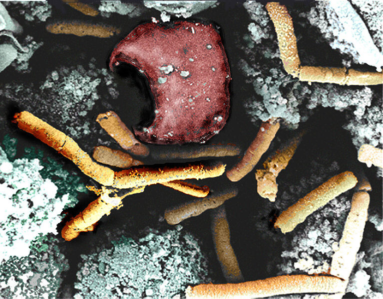  the bacteria that causes anthrax