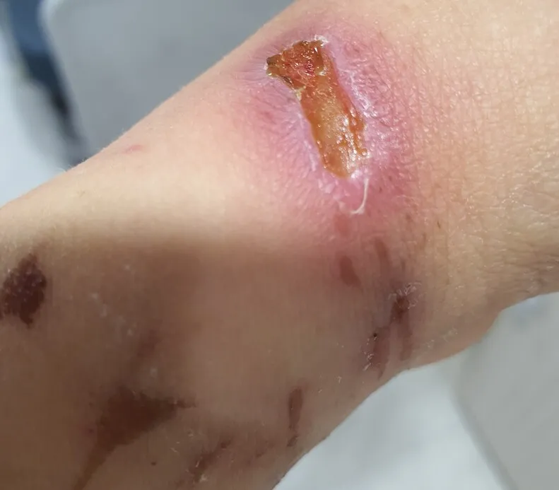 [단독] “실실 웃으며 양손 더 꽉 묶어…병원 창틈 ‘SOS 쪽지’ 날렸지만”