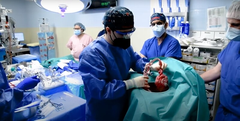 메릴랜드의대 외과의사들이 사람에게 이식할 돼지 심장을 준비하고 있다. 메릴랜드의대 동영상 갈무리