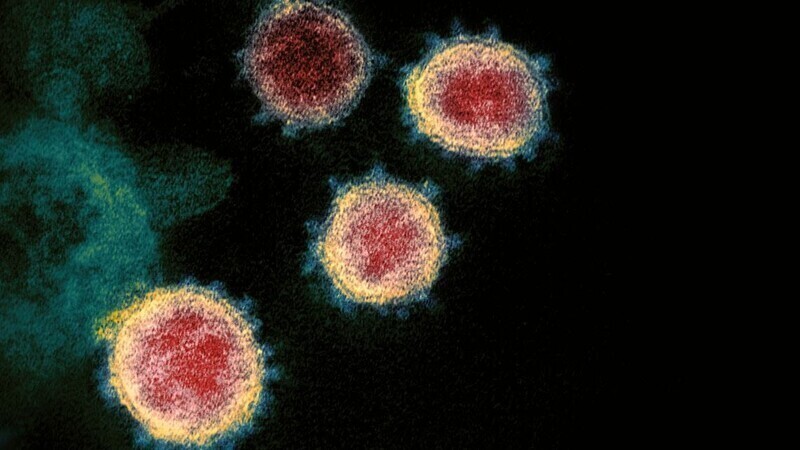 Particles of the SARS-CoV-2 virus, known as COVID-19, captured by a transmission electron micrograph. (provided by the NIAID)