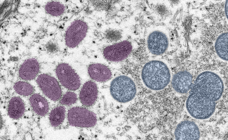 원숭이두창 바이러스는 천연두 바이러스와 같은 계통으로 증상도 비슷해 ‘천연두의 사촌’이라 불린다. 왼쪽은 성숙한 입자, 오른쪽은 미성숙 입자. 미국질병통제예방센터