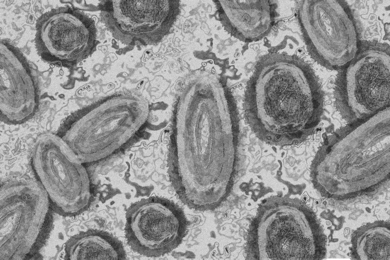 원숭이두창바이러스 전자현미경 사진. 펜실베이니아대 제공