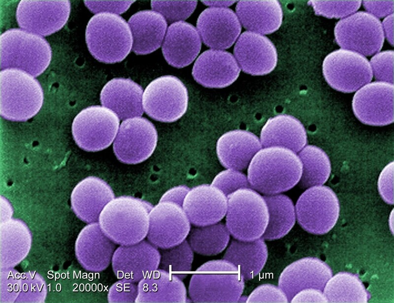 2만배율로 본 황색포도상구균의 주사전자현미경 사진. 참조 막대는 1㎛(100만분의 1m). 위키미디어 코먼스