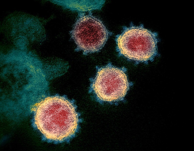 The novel coronavirus viewed through an electron microscope. (Wikimedia Commons)