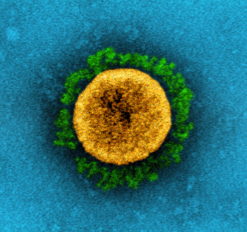 전자현미경으로 본 코로나19 바이러스의 착색 사진. 녹색이 세포 침투 도구인 돌기단백질이다. 미국 NIAID