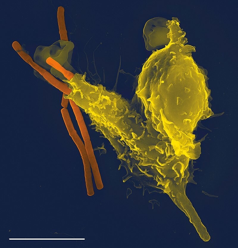 주사전자현미경으로 촬영한 호중구(노란색). 탄저병 박테리아를 포위하고 있는 모습이다. 스케일 바는 5 마이크로미터. 위키미디어 코먼스