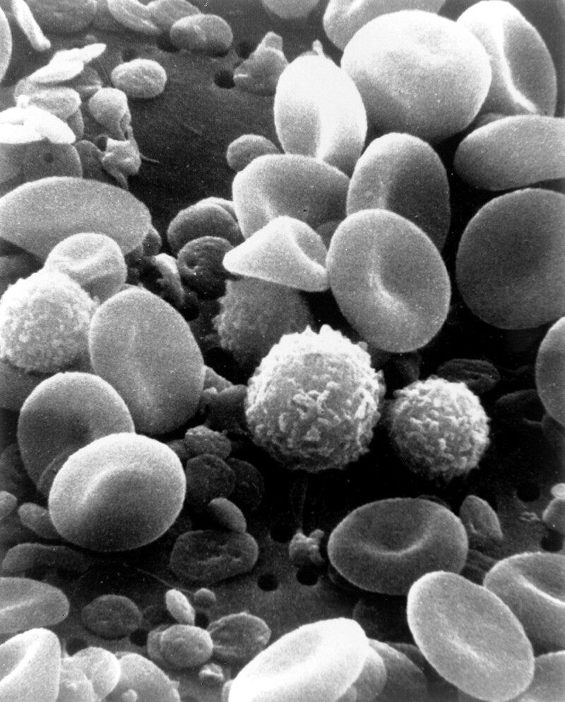 주사전자현미경으로 본 혈액. 적혈구, 백혈구, 혈소판을 볼 수 있다. 위키미디어 코먼스