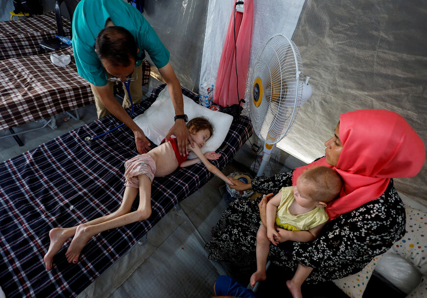 2024년 6월22일 팔레스타인 땅 가자지구 중부 데이르알발라의 구호단체가 마련한 야전병원에서 영양실조로 앙상해진 어린이가 의료진의 검진을 받고 있다. REUTERS 연합뉴스