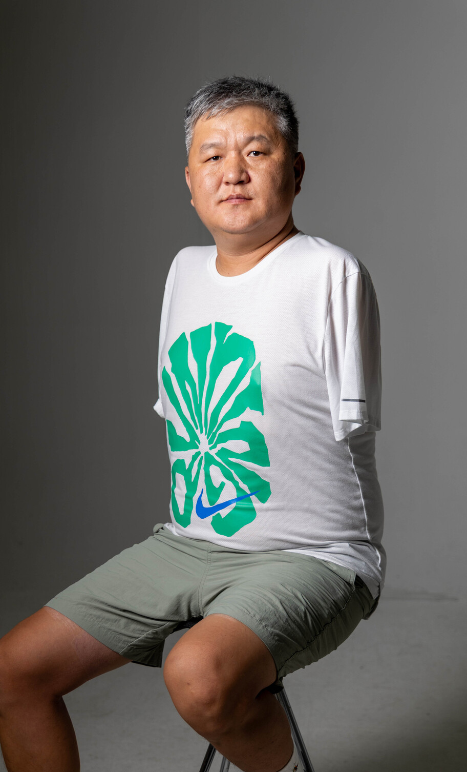 중증화상 산업재해로 양팔을 잃은 몽골 출신 이주노동자 오기나. 김진수 선임기자 jsk@hani.co.kr