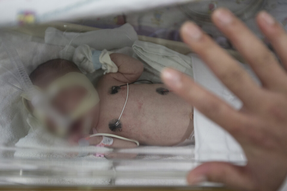 한 아이가 신생아중환자실에서 산소호흡기를 입에 문 채로 인큐베이터에 누워있다. 한겨레 자료