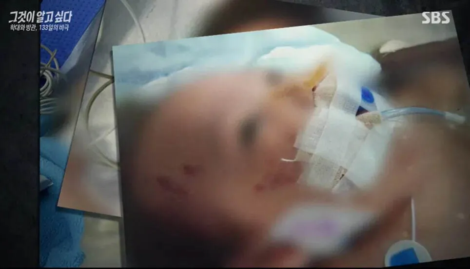 '23곳 골절 사망' 4개월 아기...닷새 만에 5만명 청원 "부모 엄벌하라... - 뉴스 썸네일 이미지