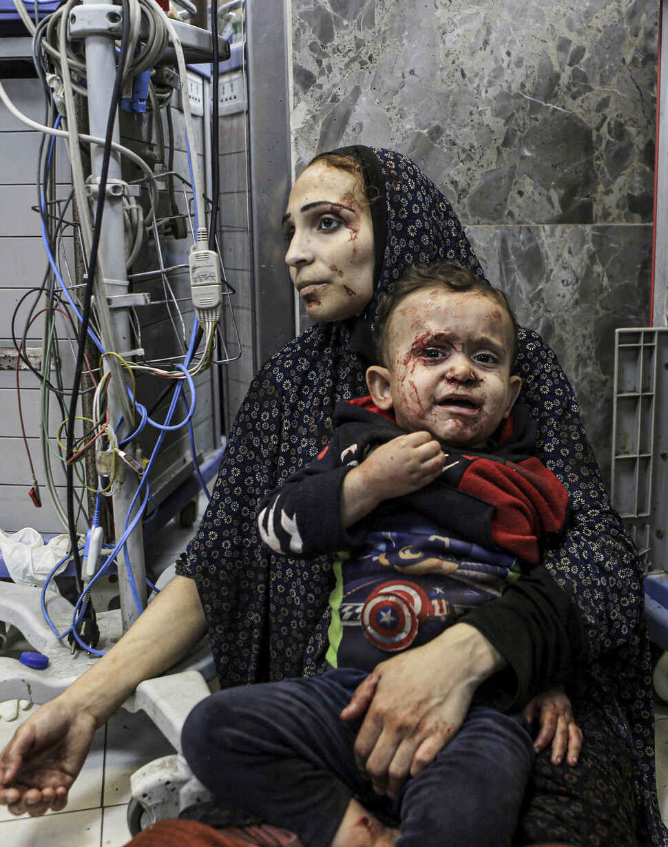 2023년 10월17일 가자지구 가자시티 알 시파 병원에서 상처입은 팔레스타인인이 치료를 기다리고 있다. AP 연합뉴스