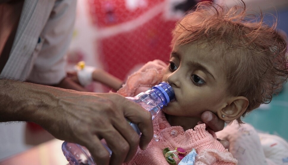예멘 후데이다의 한 병원 수유센터에서 9월27일 아버지가 영양실조에 걸린 아이에게 물을 먹이고 있다. 미국의 지원을 받은 아랍에미리트 동맹군이 예멘 항구도시 후데이다를 다시 공격했다.