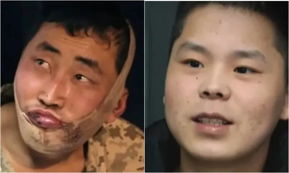 “북한군 포로 2명 한국 도착 확인”…젤렌스키도 유엔서 밝혀