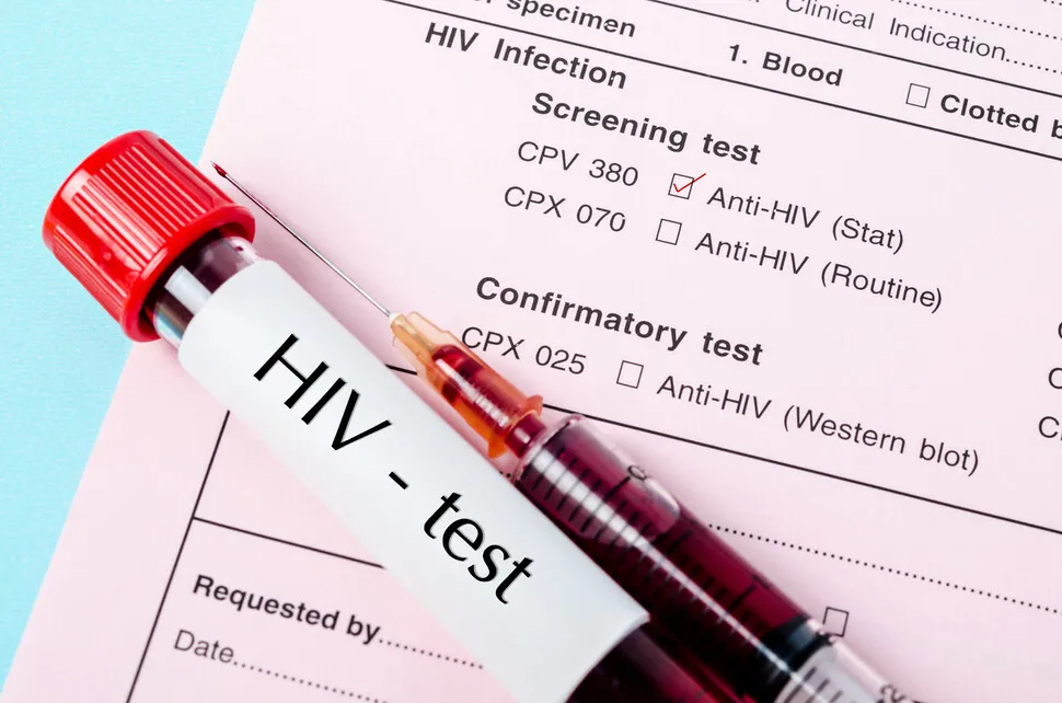 HIVは、慢性疾患のように、オフィスの内外で統合されたケアを必要とします。 [건강한겨레]