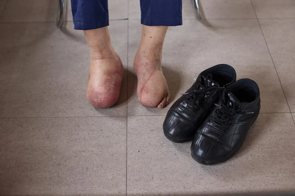 В честь 60-летия корейское общество пластических хирургов провело фотовыставку, разъясняющую суть восстановительной медицины