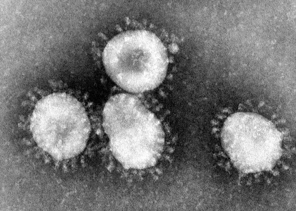 일본 국립감염증연구소가 분리해낸 신종 코로나바이러스의 전자현미경 사진. 연합뉴스