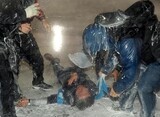 民衆総決起大会の放水銃犠牲者、意識回復しても脳出血で麻痺残る可能性
