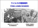 韓国中央臨床委「新型コロナ再感染はウイルス学的に不可能」