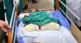 爆撃で両親も両脚も失った４歳児…「こどもに一体何の罪があるのか」