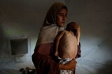 イスラエルの遺産相が暴言「ガザに飢餓はない、われわれは怪物を殺す」